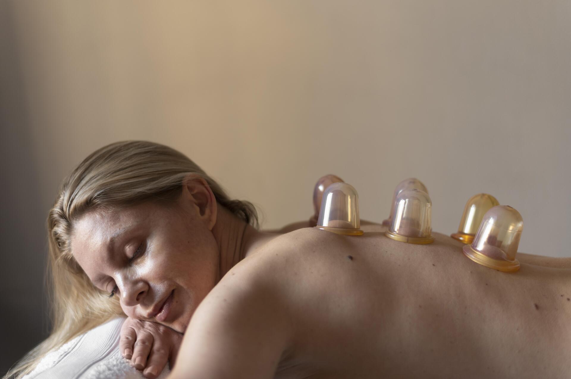 medium shot woman experiencing cupping therapy